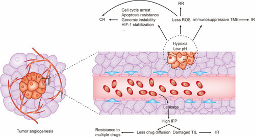 Figure 2 Tumor angiogenesis induces drug resistances through multiple mechanisms including inducing hypoxia, acidosis, and high IFP.