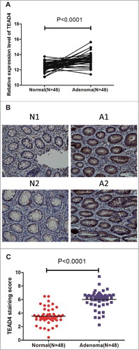 Figure 1. TEAD4 expression is upregulated in CRA. (a) Analysis of TEAD4 expression (RT-PCR, mRNA level) in CRA and their matched adjacent mucosa in Renji dataset. N = 48, paired sample t test. (b) Immunohistochemical analysis of TEAD4 in CRA tissues and paired normal colorectal mucosa (original magnification × 400). (c) Analysis of TEAD4 expression (Immunohistochemical analysis, protein level) in CRA and their matched adjacent mucosa in Renji dataset. N = 48, t test.