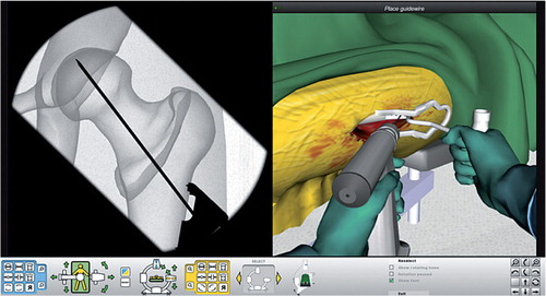 Figure 1. Split-screen view on monitor.