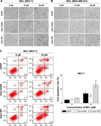 Figure 5 Drp1 overexpression sensitizes breast cancer cells to MCL-induced apoptosis.