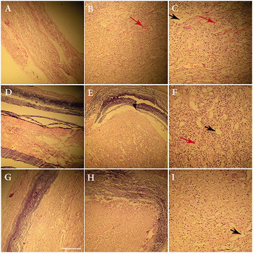 Figure 7. Hematoxylin/eosin staining of the regenerated nerves in different groups after 12 weeks of Surgery. Autograft group (A, B, C), conduit (D, E, F) and Conduit + NGF groups (J, H, I). Longitudinal directions: A, D, G (×10) and cross-sections: B, E, and H (×20). Long arrows: vacuole degeneration; short arrows: blood vessels).