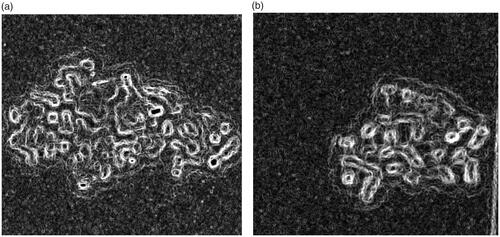 Figure 8. Representative bright-field microscopy images of Vero as the normal cells after 24 h exposure with 5.0 mg/mL nanodiamond alone (a) and 1.0 mg/mL doxorubicin alone (b). The interaction of doxorubicin with Vero was much higher than that of nanodiamond. All images are shown with 40× magnification.