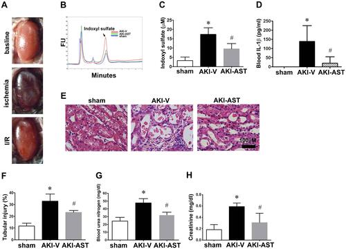 Figure 2 Morphology and characterization of levels of blood urea nitrogen (BUN), creatinine, and indoxyl sulfate after I/R injury. (A) Gross appearance of the kidneys. Mice were sacrificed 2 days post surgery, and then stained with hematoxylin and eosin (H&E). (B and C) Chromatograms of standard solutions and serums. Typical chromatograms obtained with the serum of the sham group (blue), the AKI-V (red), and the AKI-AST (green). (D) IL-1β levels in plasma from the sham, AKI-V, and AKI-AST groups measured by ELISA. The data are expressed as the mean ± SEM (n = 5) per group; *p < 0.05 vs the sham group; #p < 0.05 vs the AKI-V group. (E) High-magnification images showing tubular necrosis, the absence of nuclei, and tubular dilation in the AKI-V group at 48 h. Scale bar = 100 μm. (F) Semiquantitative analysis of tissue damage at 48 h after I/R injury (total injury score based on tubular necrosis, the absence of nuclei in tubular cells, and tubular dilation). (G and H) BUN and creatinine levels in the three groups; data are presented as mean ± SEM. n = 5 per group, *p < 0.05 vs the sham group, #p < 0.05 vs the AKI-V group.