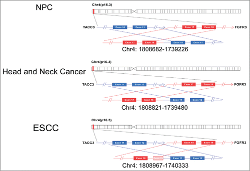 Figure 3. Different forms of FGFR3-TACC3 fusion genes at the genomic DNA level. Different forms of FGFR3-TACC3 fusion transcripts at the genomic DNA level. Each rectangle indicates an exon of the FGFR3 (red) or TACC3 (blue) gene.