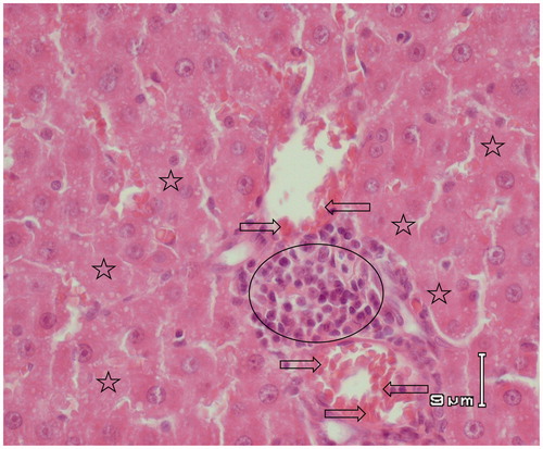 Figure 5. Paraffin sections stained by haematoxylin and eosin (H&E) for histopathological examination of liver tissues of rats treated with APAP (500 mg/kg). The arrows indicate haemorrhage in hepatic parenchyma. Circle shows inflammatory cell infiltrations and asterisks indicate hepatic cell necrosis.