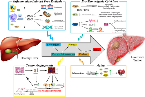 Figure 1 Chronic inflammatory microenvironment mediates HCC transformation.