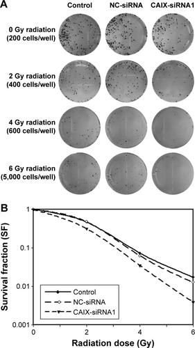 Figure 4 Knockdown of CAIX expression enhanced the radiosensitivity of CEN-2 cells.