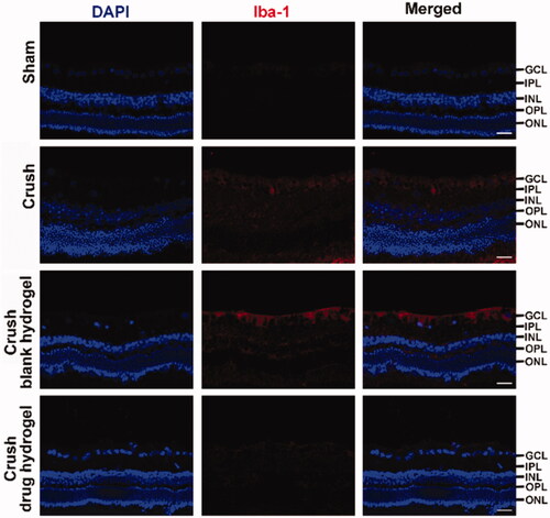 Figure 6. The Iba-1 expression profiles in retina from rabbits after receiving different treatment. Scale bar =20 μm.