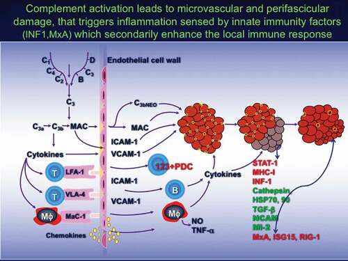 Figure 1. Complement activation leads to microvascular and perifascicular damage, that triggers inflammation sensed by innate immunity factors (INF1, MxA) which secondarily enhance the local immune response [modified from [Citation1,Citation7]].