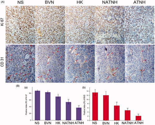 Figure 6. Immunohistochemical analysis of tumor tissue from mice that received different treatment. (A) Representative immunohistochemical images of tumor tissue from mice in various group. (B (a)) and (B (b)) represent the quantitative analysis of Ki 67 and CD 31 expression in xenografts from mice in various group, respectively. The red arrows indicate the positive expression of CD 31. *p < 0.05 and **p < 0.01, ATNH, NATNH, HK and BVN relative to NS group. Original magnification, ×200.The quantitative analysis was performed with IPP. (See color figure in the online version.)