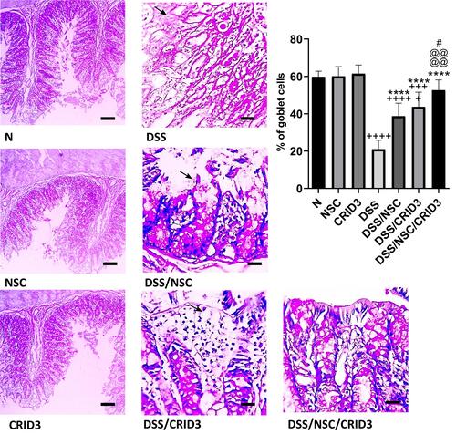 Figure 2 Effect on goblet cells percentage. Photomicrographs of PAS-stained colon sections from: (N), (NSC), and (CRID3) show normal goblet cell density, X 100; (DSS), shows diffuse loss of goblet cells (filled arrow), X 400; (DSS/NSC), shows focal decrease in goblet cell density (filled arrow), X 400; (DSS/CRID3), shows focal decrease in goblet cell density (filled arrow), X 400; (DSS/NSC/CRID3), shows marked increase in goblet cell density, X 400. As shown in % goblet cell density, the DSS rat colons have the lowest percentage of goblet cell density. In addition, the DSS/NSC/CRID3 gp show marked increase in the percentage of goblet cell density compared to that of the DSS gp. +++P < 0.001 vs N,++++P < 0.0001 vs N, ****P < 0.0001 vs DSS, @@@@P < 0.0001 vs DSS/NSC, #P < 0.05 vs DSS/CRID3.