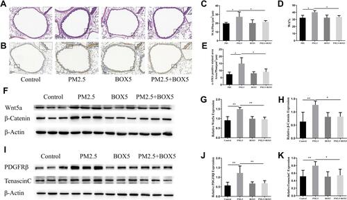 Figure 5 BOX5 alleviated PM2.5-induced airway remodeling in mice. Mice were randomly divided into PBS, PM2.5, BOX5, and PM2.5+BOX5 groups. (A) H&E staining showed that BOX5 alleviated the PM2.5-induced airway wall thickening. (B) Immunohistochemistry showed that BOX5 decreased PM2.5-induced increase in α-SMA protein expression. (C) BOX5 decreased the PM2.5-induced increase in WAt/Pbm (μm2/μm). (D) BOX5 decreased the PM2.5-induced increase in WA%. (E) BOX5 decreased the PM2.5-induced increase in the α-SMA-positive area. (F–H) Western blot analysis showed that BOX5 reduced PM2.5-induced increases in Wnt5a and β-Catenin expression in the mouse lung tissue. (I–K) Western blot analysis showed that BOX5 reduced the PM2.5-induced increases in PDGFRβ and tenascin C expression in the mice lung tissue. *P<0.05, **P<0.01, n=5.