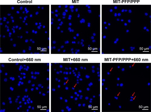 Figure 4 Nuclear staining by Hoechst 33342 in MCF-7/ADR cells treated with MIT and MIT-PFP/PPP mixed micelles with or without laser irradiation at the power of 24 mW for 0.5 h with a 660 nm fiber-coupled laser system.Notes: The experiments were carried out in triplicate. The arrows indicate nuclear morphologic changes and chromosome condensation.Abbreviations: MIT, mitoxantrone; PFP, poly(ε-caprolactone)-pluronic F68-poly(ε-caprolactone); PPP, poly(d,l-lactide-co-glycolide)–poly(ethylene glycol)–poly(d,l-lactide-co-glycolide).