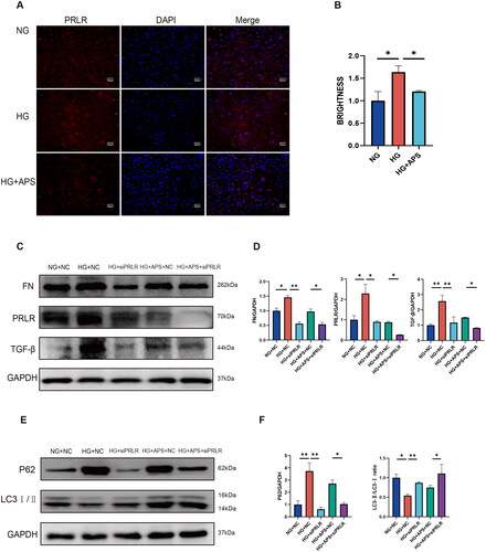 Figure 7. Knockdown of PRLR ameliorates high glucose-induced fibrosis and enhances autophagy in NRK-52E cells. (A, B) The expression of PRLR was evaluated by immunofluorescence (n = 3). (C–F) The expression of FN, TGF-β, P62, and LC3 was evaluated by western blotting (n = 3). NRK-52E cells were treated with 500 μg/mL APS. Data are presented as the mean ± SD. *p < .05; **p < .001.