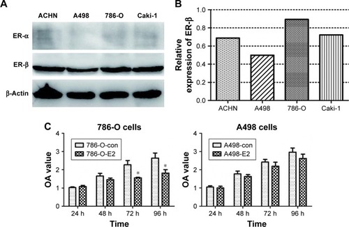 Figure 1 (A and B) The expression of ER-α and ER-β in four human RCC cell lines. (C) Effect of E2 on 786-O and A498 cell proliferation (*P<0.05).