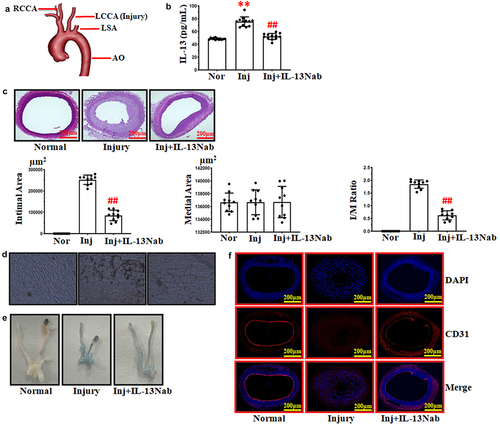 Figure 1. Neutralizing IL-13 stimulated the recovery of ECs after balloon injury. (a) schematic summary of the balloon injury model. (b) ELISA analysis of IL-13 serum level. **p < .01 vs. normal; ##p < .01 vs. injury. (c) treatment with IL-13Nab (30 ng) inhibited intimal hyperplasia following balloon injury after 14 days. ##p < .01 vs. injury. Scale bars: 200 μm. (d-e) silver andEvans blue staining to detect the recovery of endothelial cells after balloon injury. (f) immunofluorescence staining for CD31 (red) and DAPI (blue), scale bars: 200 μm. The results were derived from 3 independent experiments each performed in duplicate. Normal, nor. Injury, Inj. Neutralizing IL-13, IL-13Nab.