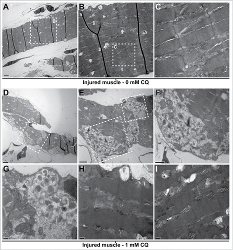Figure 5. Blocking autophagy affects cytoplasmic organization of the regenerating muscle. Fish were myectomized and treated with or without CQ, 5 d later the regenerating muscle was extracted and imaged by electron microscopy. (A) Electron micrography of regenerating muscles without CQ treatment, scale bar: 2 μm. (B, C) High-magnification images of the boxes in (A)and (B)showing the typical sarcomeric structure; scale bars represent 1 μm and 200 nm, respectively. (D) Overview of the regenerating muscle of treated fish, note the high amount of unresolved autophagosomes, scale bar: 2 μm. (E) View of the box in (D)showing an example of unresolved autophagosomes, scale bar: 1 μm. (F, G) High-magnification views of the boxes in (E)revealed that the autophagosomes were filled with undigested cellular debris; scale bars represent 600 nm and 200 nm, respectively. (H, I) In addition to the unresolved autophagosomes, the analysis of the CQ-treated fish revealed that the regenerating muscle contained a high proportion of disorganized sarcomeres (compare to C); scale bars: 200 nm. This was not found in the injured muscles of untreated fish.
