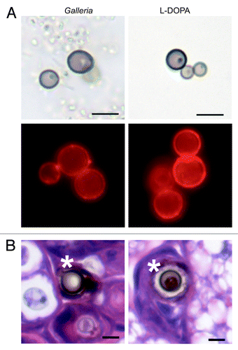 Figure 2. Analysis of melanin produced by C. neoformans. (A) Melanin “ghosts” were isolated from fungal cells grown in the presence of G. mellonella homogenate or l-DOPA. The melanin ghosts were visualized by light microscopy (top row) and immunofluorescence with a melanin-binding antibody (bottom row). (B) G. mellonella was infected with C. neoformans strain H99. After 5 d, larvae were sacrificed and fixed. Sections were stained with hematoxylin and eosin. Asterisks indicate pigmented C. neoformans cells. Scale bars, 5 μm.