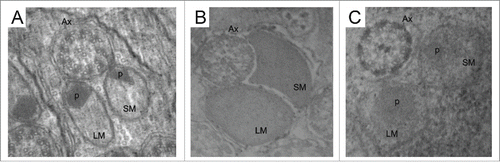 Figure 3. Ultrastructure of transverse section of the spermatozoal tail of S. latifasciaeformis (A), Z. tuberculatus (B) and Z. megalorchis (C) Note the presence of the axoneme (Ax) and 2 mitochondrial derivatives of different sizes: larger mitocondrial derivative (LM), smaller mitochondrial derivative (SM); the accumulation of paracrystalline material (p) is visible in S. latifasciaeformis and Z megalorchis. Scale: Figures A, B, C: 84000 x.