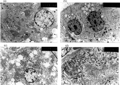 Figure 9 a) Ultrastructure was basically normal except that endoplasmic reticulum dilatation, fat denaturalization and high electron density granules were observed in hepatocytes of rabbits exchange transfused by PEG-bHb containing MetHb of 5%, 8% and 15% (group B, C, and D) (× 4000). b) There're endoplasmic reticulum dilatation and increase of lysosome in renal tululae epithelial cells of group B, C, and D rabbits, other organelles were normal (× 4000). c) Except changes mentioned in group B, C, and D, partial cell organelle collapse occurred in hepatocytes of group E (× 4000). d) Partial cell organelle collapse were also observed in renal tubule epithelial cells of group E rabbits (× 4000).