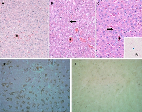 Figure 3 Conventional light microscopic histology of representative rat liver tissue removed (A) three days and (B) six months after implantation of superparamagnetic iron oxide nanoparticles. (C) Liver tissue of a sham-treated animal after six months. All visual fields include a central vein. Neither iron storage in hepatocytes nor fibrosis is seen. Arrows in (B) and (C) point to minute iron deposits in a Kupffer cell flanking a sinusoid. This chance finding is due to age-related increase of Kupffer cells and is therefore less likely to be encountered in young animals. (A) Iron granules are readily distinguished from lipofuscin pigment using Prussian Blue staining (inset in C). Slides not labeled otherwise represent hematoxylin and eosin staining; original magnification 200×. Representative section of rat liver using active caspase-3 antibody staining at three days (D) 40× and cleaved caspase-3 antibody staining at six months (E) 40× demonstrated no apoptotic activity. Sham caspase is not shown because no difference was detected.