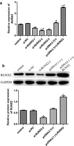 Figure 3. Cell transfection efficiency analysis based on runt-related transcription factor 2 (RUNX2) expression. (a) The mRNA expression of RUNX2 after transfection using real-time quantification PCR (RT-qPCR). (b) The protein expression of RUNX2 based on Western blot. *: P < 0.05, compared with the control group. #: P < 0.05, compared with si-RUNX2-1.