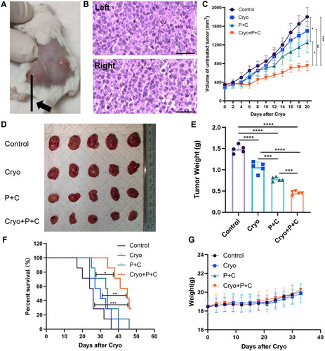 Figure 3. Cryo with PD-1/CTLA-4 monoclonal antibody combination therapy produces synergistic antitumor effects. A. Cryo of the left tumor and preservation of the right tumor. B. H&E staining of the tumor tissue. Bars = 50 µm. C. Growth of the tumors on the untreated side during the observation period. D. Tumor specimens of the tumors on the untreated side in each group on Day 20 after Cryo. Five representative tumor specimens were taken from the untreated side of each group. E. Weight of the tumors on the untreated side in each group on Day 20 after Cryo. F. Survival time curves of each group of tumor-bearing mice. G. Body weights of each group of tumor-bearing mice. N = 7.