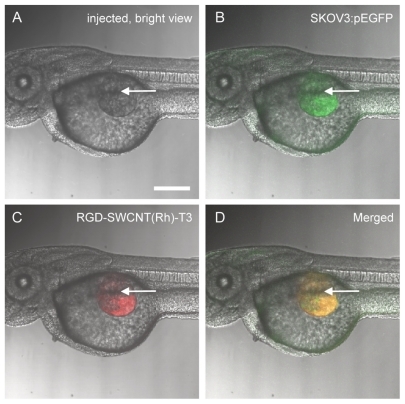 Figure 7 Tumor xenograft model in zebrafish embryos. Zebrafish embryos have been microinjected with fluorescent-labeled SKOV3:pEGFP mammalian cells suspended in Matrigel. The microinjection was conducted through the perivitelline space between the yolk and the periderm, close to the developing SIVs. The injection site is indicated by bright view in (A) using a white arrow, green fluorescence in (B) indicates presence of fluorescent-labeled SKOV3:pEGFP mammalian cells after injection, red fluorescence in (C) indicates presence of RGD-SWCNT(Rh)-thalidomide after injection, and (D) is (B) and (C) merged together. Scale bar: 150 μm.Abbreviations: RGD, cyclic arginine-glycine-aspartic peptide; SWCNT, single-walled carbon nanotubes; Rh, rhodamine; EGFP, enhanced green fluorescent protein; SIVs, subintestinal vessels.