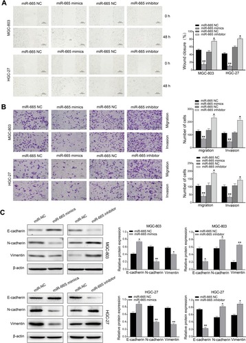 Figure 3 miR-665 inhibits GC cell invasion, migration, and EMT process. (A) Wound healing assays were performed to detect invasion and migration capacity of MGC-803 and HGC-27 cells transfected with miR-665 mimics or miR-665 inhibitor. (B) Transwell assays were performed to reveal invasion and migration capacity of GC cells transfected with miR-665 mimics or miR-665 inhibitor. (C) Protein expression levels of E-cadherin, N-cadherin, and vimentin were measured by Western blotting 24 h after transfection with miR-665 mimics or miR-665 inhibitor in MGC-803 and HGC-27 cells. Data are presented as mean ± SD. *P < 0.05, **P < 0.01.