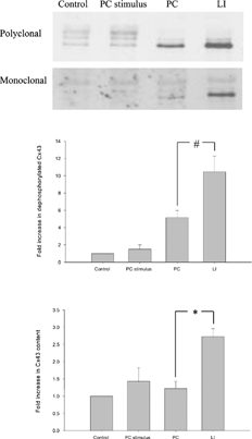 Figure 6 Immunoblot of Cx43 in myofibroblasts subjected to nontreatment (control), 30 min of ischemic buffer followed by 30 min maintenance buffer (PC stimulus), 30 min of ischemic buffer followed by 30 min maintenance buffer and 4 h of ischemic buffer (PC) and ischemic buffer for 4 h (LI) for both monoclonal and polyclonal anti-Cx43 antibodies. Dephosphorylated (upper bar chart) and total (lower bar chart) Cx43 content were quantified by the polyclonal immunoblot (signal intensity normalized to a control value of 1.0, n = 4). #p = 0.038, *p = 0.002 PC vs LI.