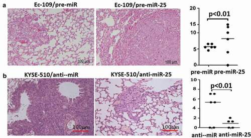 Figure 6. Effect of miR-25 lung metastasis in mice.