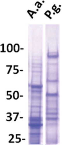 Figure 1. Analysis of antigen preparations from A. actinomycetemcomitans (A.a.) and P. gingivalis (P.g.) as used for coating of ELISA plates.Lanes of sodium dodecyl sulfate polyacrylamide (7%) gels were loaded with amounts of antigens equal to those used for coating of one 96-well plate. Staining with Coomassie Blue (polysaccharides and LPS) are not visible. Mr markers in kilo Daltons.