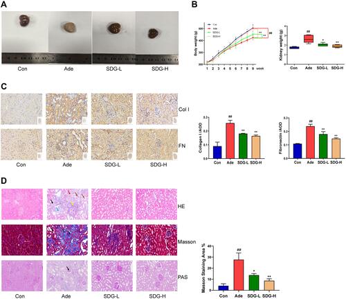 Figure 1 SDG Improved Renal Tissue Fibrosis in Rats With Adenine Nephropathy. Experimental schedule: The adenine, SDG-L, and SDG-H groups underwent intragastric administration of adenine (2.5%, 200 mg/kg/d) every day for 4 weeks and then on alternate days for another 4 weeks. SDG-L and SDG-H groups were administered 5 g/kg/d or 10 g/kg/d SDG by gavage once a day. The rats were sacrificed in week 9. At this point, (A) morphology of the kidneys was observed, (B) the body weight and kidney weight was measured, (C) and representative images of the sections of the kidney were assessed using immunohistology using Collagen I (Col I) and Fibronectin (FN) antibodies. Scale bar = 50 µm. (D) Hematoxylin and Eosin staining: In the adenine group, a large area of renal interstitial inflammation was observed (brown arrow). The number of renal tubules decreased (black arrow), and kidney atrophy was observed along with a change in their structure (blue arrow). More lymphocyte infiltration was observed in the interstitium (yellow arrow), and the lumen of some renal tubules around the lesion was enlarged; also, the epithelial cells were swollen (red arrow). Masson staining: In the adenine group, there was extensive damage to the cortex, and more collagen fibers were observed at the damaged site and the dark-blue colored regions surrounding the renal tubular interstitium (black arrow). Periodic Acid-Schiff staining: There was no obvious increase in the mesangial matrix and thickening of basement membrane in the glomeruli in the adenine group. However, a small number of renal tubules in the medulla were PAS-positive (black arrow). Scale bar = 50 µm. Data are presented as means ± SD; n = 6. ##P < 0.01 vs control. *P < 0.05; **P < 0.01 vs the adenine group.