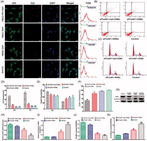 Figure 2. Transfection efficiency, cell apoptosis and cycle, cell viability, gene silencing efficiency of siFoxM1-Apt-CNBs in vitro. (A) Detection of the intracellular localization of Cy3-siRNA and measurement of the transfection efficiency through CLSM and flow cytometry, respectively. Blue (DAPI) is a representation of cell nuclei, green (DiO) reveals the cytomembrane, whereas the red (Cy3) dots imply Cy3-labeled FoxM1NCsiRNA. (B, C) The apoptotic and cycle of LNCaP cells were detected by flow cytometric after transfection for 48 h. (D, E) Quantitative flow cytometric analysis of the percentage of cell apoptotic and cell cycle changes after transfection for 48 h, *p < .05, **p < .01, compared with siFoxM1-Apt-CNBs groups, n = 3. (F) LNCaP cell viability was measured with CCK-8 after transfection treatment for 48 hours. (G, J, and K) The FoxM1, E-cadherin protein expression levels were detected by western blotting after 48 hours of transfection treatment. (H, I) The FoxM1 and E-cadherin mRNA expression levels were evaluated by RT-PCR after 48 hours of transfection treatment. #p < .05, *p < .05 compared with the control, siFoxM1-NNBs and siFoxM1-Apt-CNBs groups; ##p < .01, **p < .01 compared with the control and siFoxM1-NNBs groups, n = 3; Scale bars =20 μm.