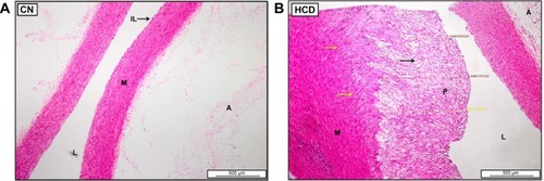 Figure 13 Photomicrographs of aorta of CN (A) and HCD (B) groups.