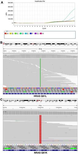 Figure 2 ARMS-PCR demonstrated EGFR mutations L858R and T790M (A) and NGS identified HRAS Q61L (B) and NRAS Q61K (C) mutations.