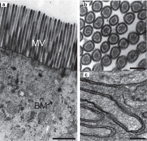 Figure 1. Ultrastructural imaging of enterocyte membranes. (a) Electron micrograph of the apical part of an enterocyte showing microvilli (MV) and the basolateral membrane (BM). (b,c) Larger magnification of cross-sectional view of microvilli (b) and the basolateral membrane (c). Bars: a. 500 nm, b. 100 nm and c. 200 nm.