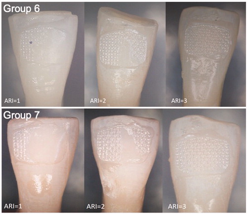 Figure 4. Stereomicroscope pictures right after bracket debonding. Adhesive remnant index (ARI) 0 = no adhesive on the tooth, 1 = less than ½ adhesive on the tooth, 2 = more than ½ of the adhesive on the tooth, 3 = all of the adhesive on the tooth, 4 = enamel fracture.