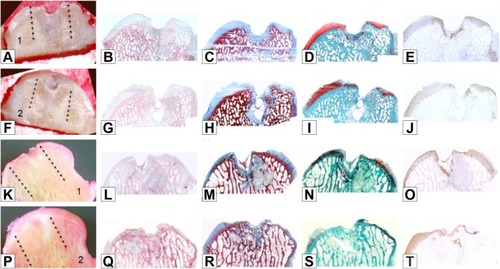 Figure 5 Untreated group: macro and histological observations of 2 condyles, sectioned in half (number 1 in images A and K: right hemicondyle; number 2 in images F and P: left hemicondyle).