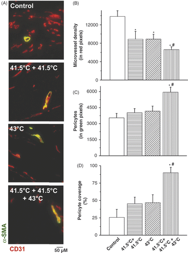 Figure 3. Histological analysis of pericytes and microvessel density (MVD) after hyperthermia treatment schedules. Co-localisation staining of pericytes (α-SMA, green) and microvessel density (CD31, red) in B16F10 tumours (A). Quantification of IF staining for microvessel density (CD31) (B), pericytes (α-SMA) (C) and pericyte covered vessels (D) by morphometric analysis. Original magnification, ×200; scale bar 50 µM. *p < 0.05 versus control; *#p < 0.05 versus 43°C treatment group. After binarisation of the images, microvessel density or pericytes were estimated by scoring the total number of representative coloured pixels per field. A pericyte-covered tumour blood vessel is considered a mature, normalised vessel.