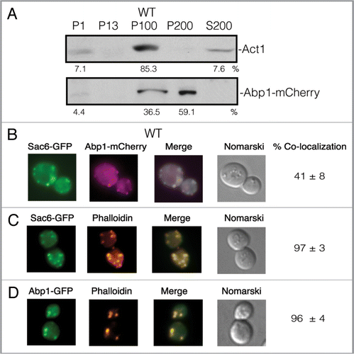 Figure 2 Abp1 and actin (Act1) are distributed in multiple locations. (A) Wild-type cells expressing Abp1-mCherry were glucose starved for 3 d. Cells were fractionated by differential centrifugation. The distribution of Act1 and Abp1-mCherry in the P1, P13, P100, P200 and S200 fractions was determined. (B) Abp1-mCherry was transformed into wild-type cells that expressed Sac6-GFP. The distribution of Abp1-mCherry and Sac6-GFP was determined. (C) Wild-type cells expressing Sac6-GFP was processed and actin patches were visualized with phalloidin conjugated with rhodamine. (D) Wild-type cells expressing Abp1-GFP was processed and actin patches were visualized with phalloidin conjugated with rhodamine.