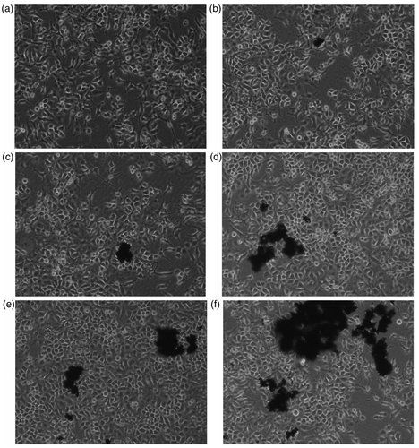 Figure 2. Changes of HELF cells morphology after exposure to DWCNTs-COOH. Concentrations of DWCNTs-COOH: (a) 0 µg/mL, (b) 1.25 µg/mL, (c) 2.5 µg/mL, (d) 10.0 µg/mL, (e) 30.0 µg/mL, (f) 50.0 µg/mL.