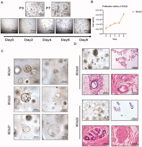 Figure 2. Long-term passage of organoids in vitro and maintain tumour heterogeneity. (A) Bright field shows the morphology of organoids with different passage times and the proliferation ability of organoids. Scale bar, 250 mm. (B) The proliferation curve of organoids tested by CellTiter-Glo 3D cell viability assay proves that the cultured organoids can survive and inherit for a long time. (C) The morphology of individual BCOs with different subtype. Scale bar, 100 mm. (D) Morphological characteristics of tumour tissue and organoids of patients who achieved pCR. The HE stain of puncture samples and surgery tissues of patients who reached pCR after neoadjuvant chemotherapy, Scale bar, 100 mm.