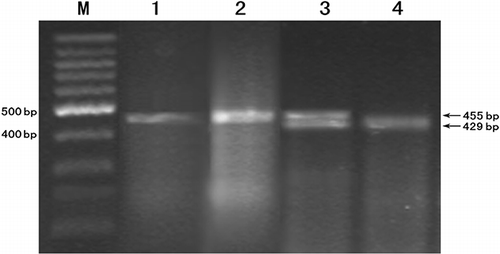 FIGURE 1. Polyacrylamide gel electrophoresis of PCR products after restriction digestion. Each genotype of C-509T was clearly defined by the method described. 1,2:CC genotype; 3:CT genotype; 4: TT genotype; M: Marker.