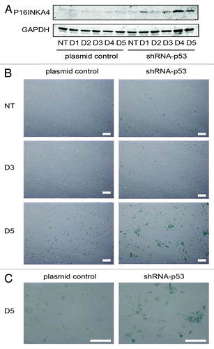 Figure 7. Senescence response of PA-1 cells to ETO treatment. PA-1 cells stably transfected with shRNA-p53 or plasmid control were treated with 8 µM ETO for 20 h, then washed and assessed at the indicated time point by (A) immunoblotting or (B) for sa-β-gal expression and cellular morphology. (A) Cell lysates were made and assessed by immunoblotting for P16INKA4 and GAPDH as a loading control. An accumulation of P16INKA4 was detected in TP53-silenced cells after ETO treatment. (B) sa-β-gal staining was used to detect sa-β-gal activity in response to ETO treatment at indicated time points. Detection of sa-β-gal activity was increased by TP53-silencing and largely mirrored the induction of P16INKA4 seen above. (C) Higher power image of the cells seen on day 5. Bar = 20 µM. Data are representative of > three independent experiments.