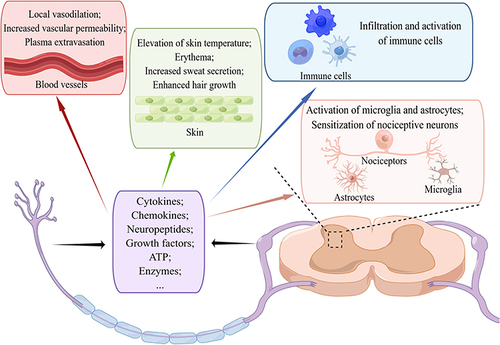 Figure 1 The role of neurogenic inflammation in the pathophysiology of CRPS. Nociceptive receptors can be activated by mechanical or chemical stimulation, leading to the release of cytokines, chemokines, neuropeptides, growth factors, ATP and enzymes. In the peripheral nervous system, these substances can induce local vasodilation, increase vascular permeability and plasma extravasation, elevate skin temperature and cause erythema, enhance sweat secretion and hair growth, as well as infiltrate and activate immune cells; in the central nervous system, they are capable of sensitizing nociceptive neurons while activating microglia and astrocytes. (By Figdraw).