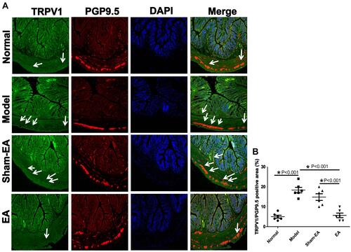 Figure 7 Effects of EA on the expressions of TRPV1 (green) and PGP 9.5 (red) in the distal colon in different groups. (A) The expression of TRPV1+ PGP 9.5+ neurons in the submucosal layer and myenteric plexus of the colonic wall. Arrows indicate the location of TRPV1+ PGP 9.5+ neurons. Scale bar=50 μm. (B) The quantitative expression of TRPV1+ PGP 9.5+ neurons in different groups. *P<0.05.