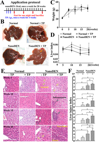 Figure 1 TP exacerbated liver damage and tumor formation in nanoDEN-treated mice.