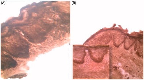 Figure 4. Chicken buccal mucosal tissue stained with osmic acid: (A) after CurSLN-gel was applied for 3 hours and (B) control.