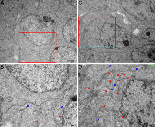 Figure 7. Transmission electron microscopy (TEM) of fyco1 homozygous knockout (fyco1−/−) mice lenses showed increased cellular organelles at postnatal day 0 (P0). (A,B) Wild type (WT) mice lenses at P0 exhibit differentiating fiber cells with few endoplasmic reticulum (ER; blue arrow), Golgi apparatus (GA; green arrow), and mitochondria (red arrow). (C,D) In contrast to WT, fyco1−/− mice differentiating lens fiber cells showed retention of ER, mitochondria, and GA. Note: Image magnifications: 9700x (A, C), and 19,400x (B, D); Scale bars: 500 nm (A, C), and 250 nm (B, D). Panels B and D are enlarged images of the boxed areas in panels A and C, respectively.